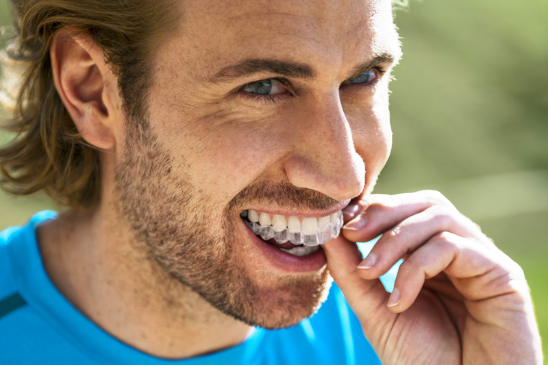 mascherina invisalign da indossare